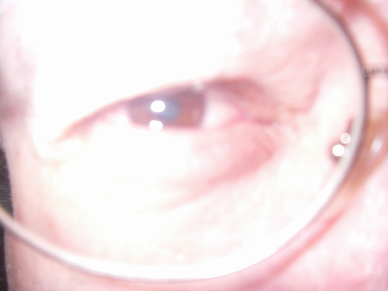 eddy's eyeball.jpg